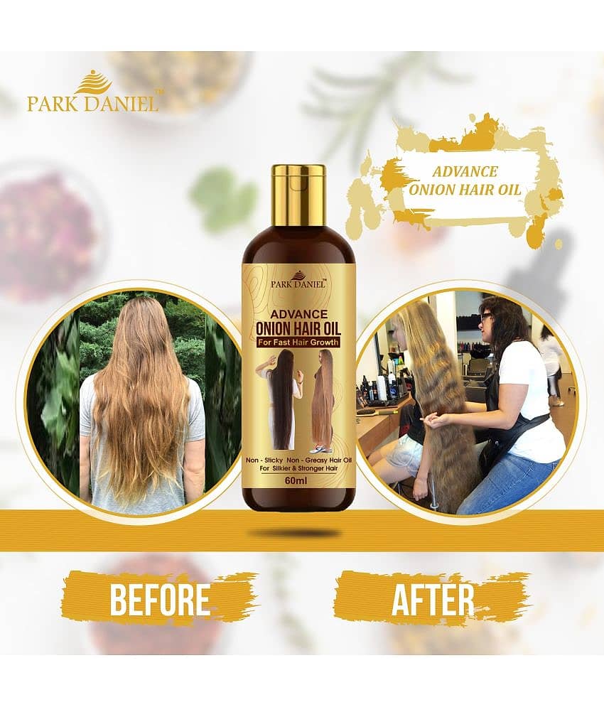Park Daniel Advance Onion Hair Oil-for Hair growth Onion oil 60 mL