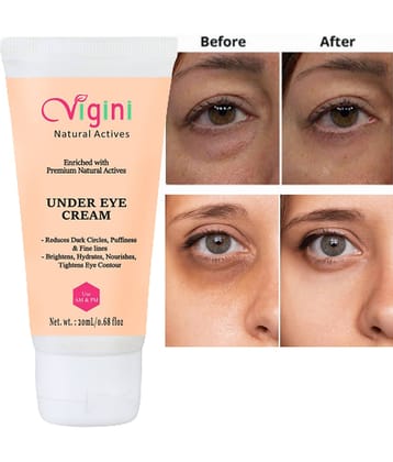Vigini Eye Roller 20 g