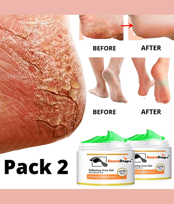 Smartdrops Chapped Hand And Foot Cream Crack Peeling Repair Anti Dry Skin Remove Dead Skin Foot Moisturizing (50gm) Pack of 2
