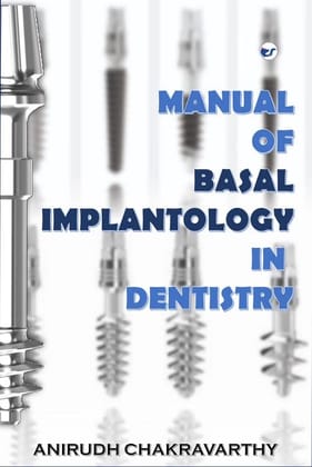 THE HANDBOOK MANUAL OF BASAL IMPLANTOLOGY [Paperback] Dr. Anirudh Chakravarthy
