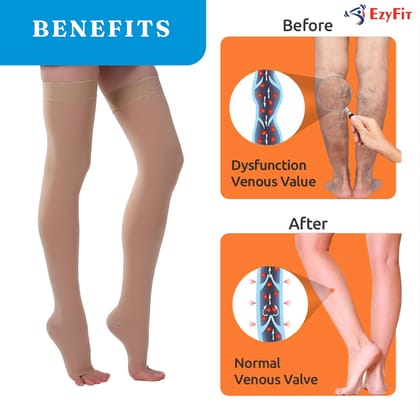 EZYFIT Imported Class II Medical Compression Stockings Above Knee | 22-35 mmHg | 30% Cotton Fabric | For Varicose Veins, Oedema, Pregnancy & Post-Surgery Recovery | Unisex (Men & Women) EZYFIT Imported Class II Medical Compression Stockings Above Knee | 22-35 mmHg | 30% Cotton Fabric | For Varicose Veins, Oedema, Pregnancy & Post-Surgery Recovery | Unisex (Men & Women)