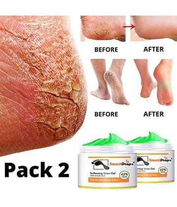 Smartdrops Chapped Hand And Foot Cream Crack Peeling Repair Anti Dry Skin Remove Dead Skin Foot Moisturizing (50gm) Pack of 2