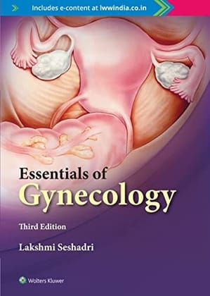 ESSENTIALS OF GYNECOLOGY