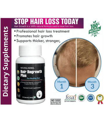 Natura Herbal Hair Fall Control & Hair Regain Capsule 60 No.S Pack of 1