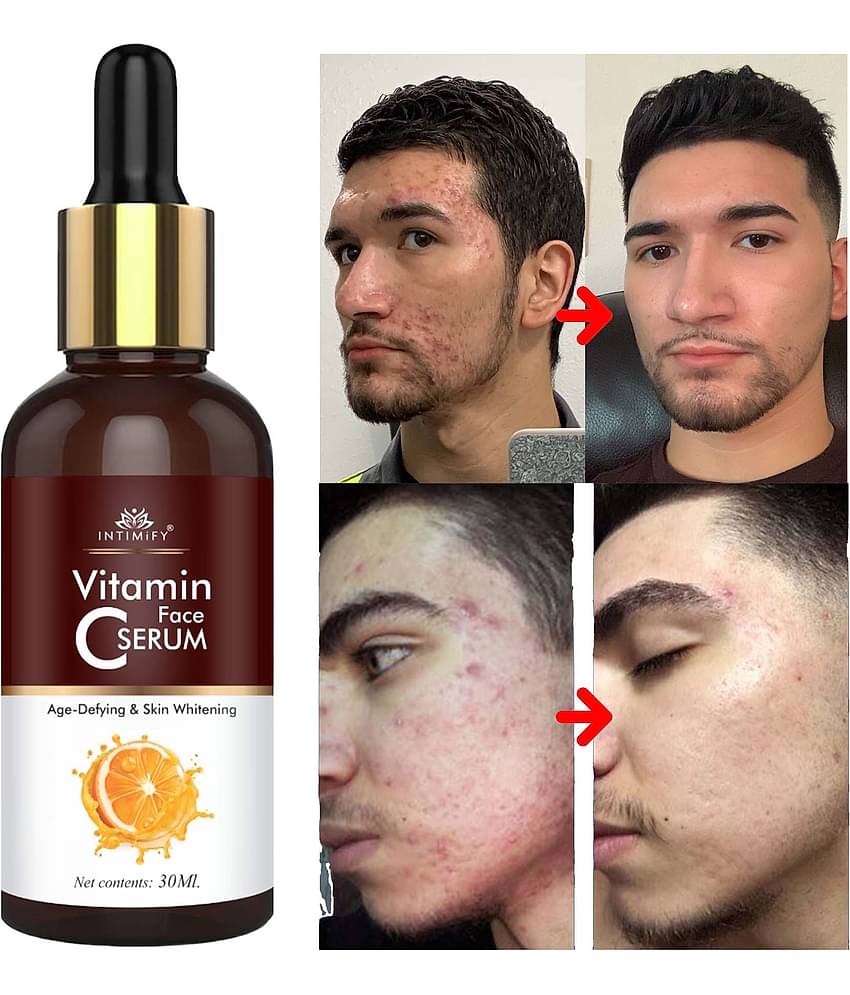 Intimify Face Serum Vitamin C Skin Toning For All Skin Type, Anti Acne Serum, 30 Ml