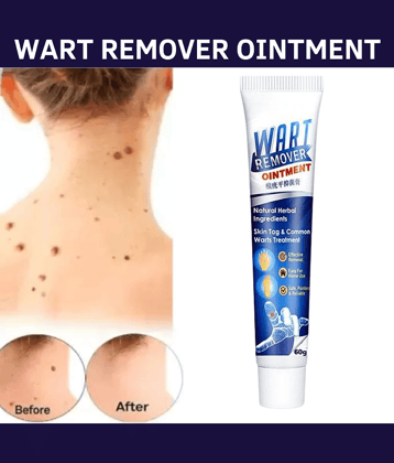 Massa Wart Remover Cream For Skin For Wart Free Skin For Men Or Women