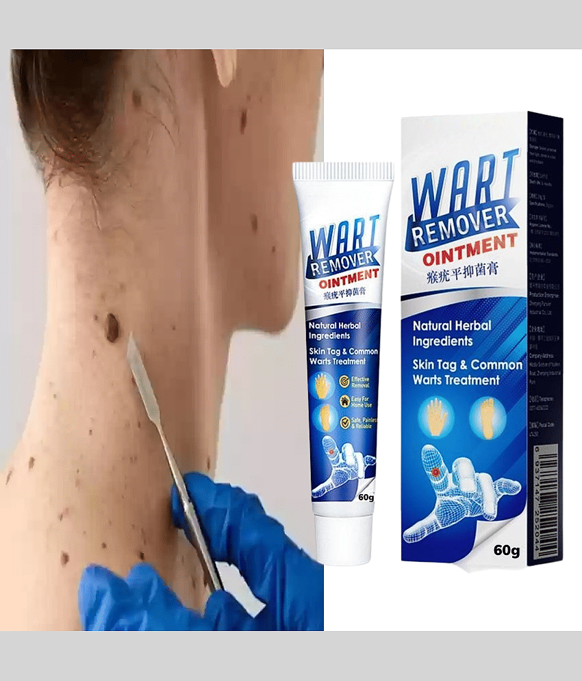 Wart Removal Ointment Skin Treatment