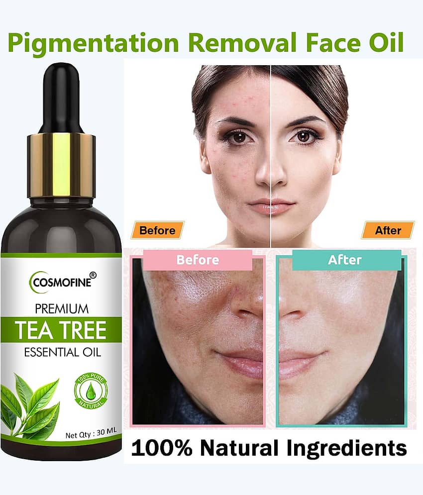 COSMOFINE Face Serum Tea Tree Pigmentation Reducing For All Skin Type ( Pack of 1 )