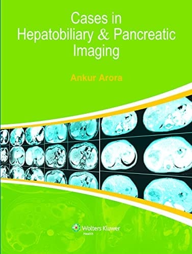 Cases in Hepatobiliary & Pancreatic Imaging 1/ed ( 2014 )