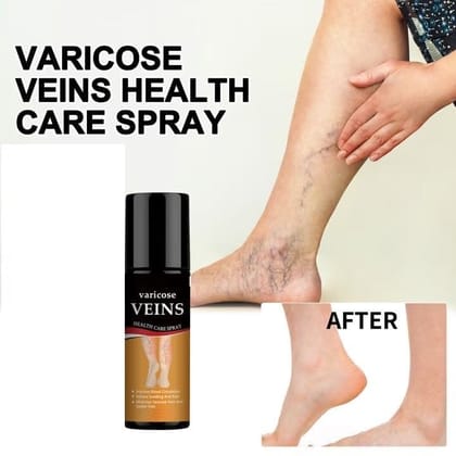 ELHAE Varicose Vein Relief Spray | Pack 2 x 100ml Herbal Leg Soothing Formula | Helps Reduce Appearance of Veins & Discomfort | Non-Greasy, Quick Absorbing | Daily Circulation Support
