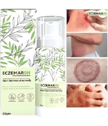 Treszo Eczemaron Anti Fungal Cream for Rapid Healing for Skin ,50 g (Pack of 1)