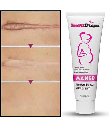 Smartdrops Light weight moisturising Cream Fruity ( 60 mL )