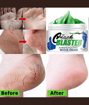 Smartdrops Smartdrops Foot Cream SPF 24 ( 150 g )