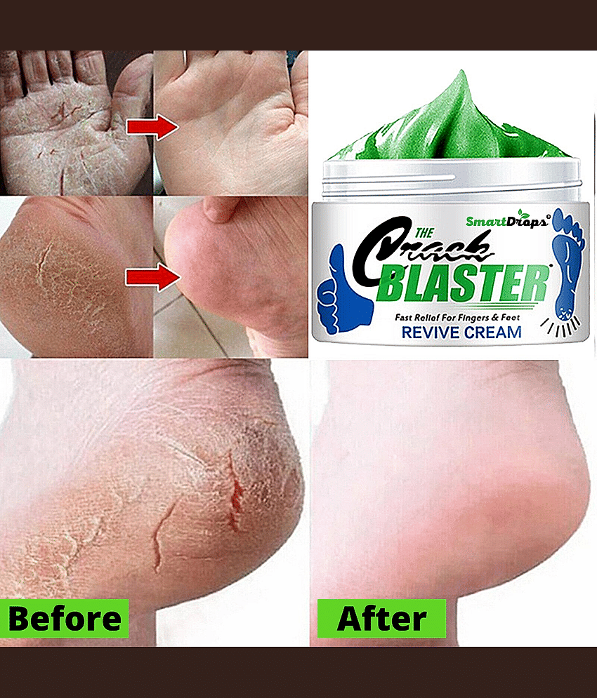 Smartdrops Smartdrops Foot Cream SPF 24 ( 150 g )