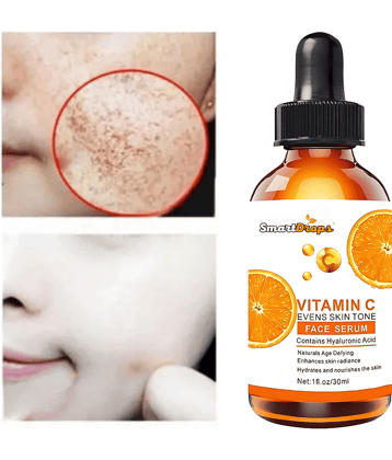 Smartdrops Face Serum Vitamin C Maintians Skin Complexion For All Skin Type ( Pack of 1 )