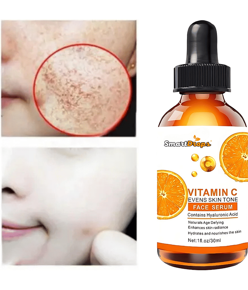 Smartdrops Face Serum Vitamin C Maintians Skin Complexion For All Skin Type ( Pack of 1 )