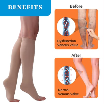 EZYFIT Imported Class II Cotton Compression Stockings Below Knee for Varicose Veins | Varicose Veins Stockings For Men and Women | 22-35mm/Hg (Extra Large)