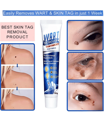 Remover Wart Without Leaving scars and refuse to repeat All Skin Type Use For Men And Women