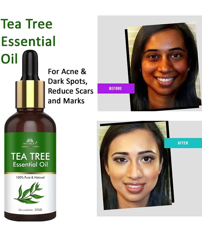 Intimify Tea Tree Essential Oil, Acne Removal Face Oil, Face Oil For Skin Whitening - 30ml