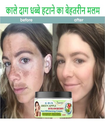 Keyoza Moisturizer All Skin Type Aloe Vera ( 50 gm )