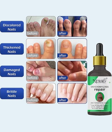 Newsio Manicure & Pedicure Kit ( Pack of 1 )