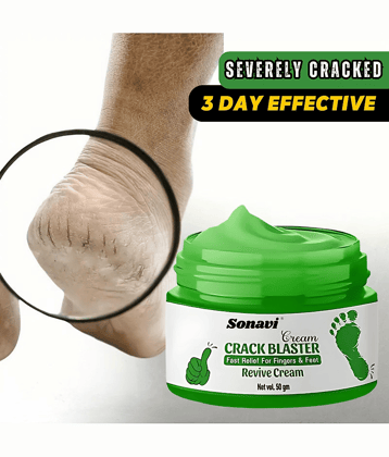 Sonavi Removes Patches Cream for All year ( 50 g )