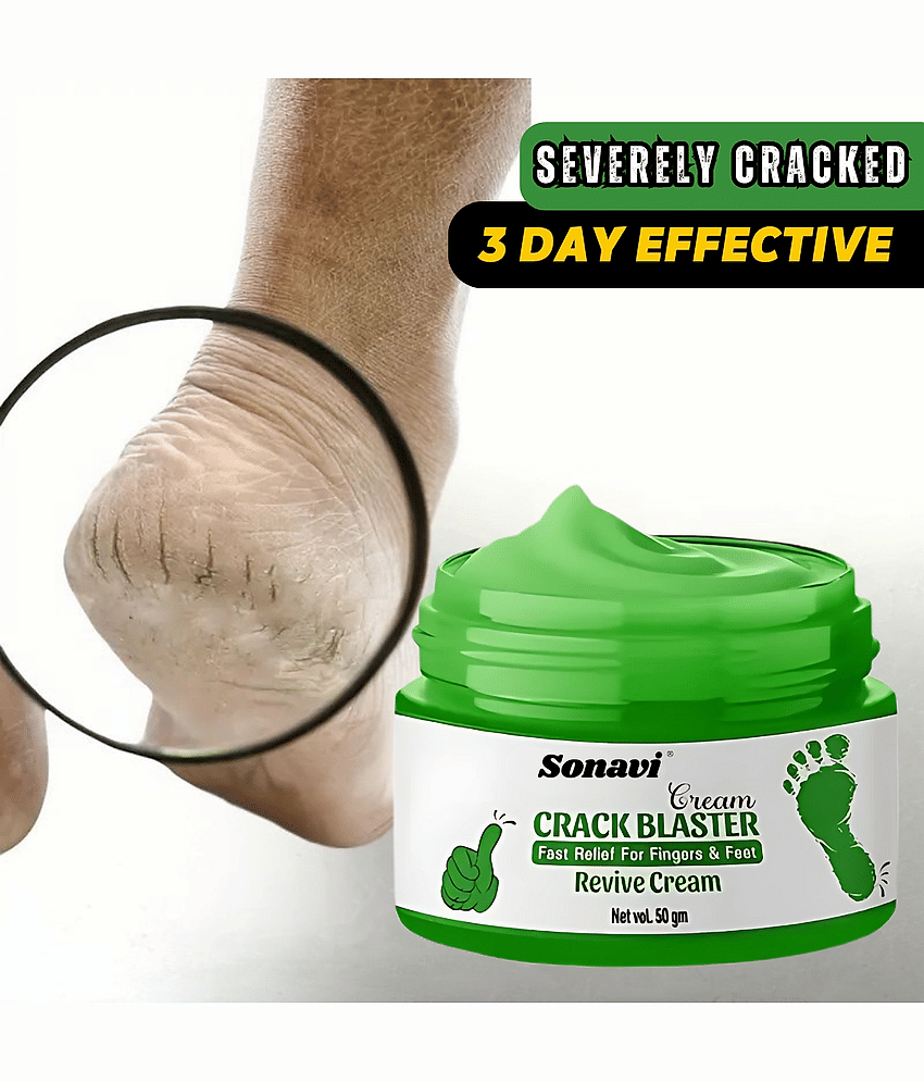 Sonavi Removes Patches Cream for All year ( 50 g )