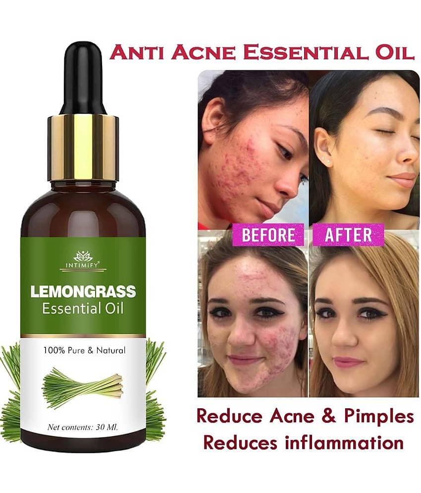Intimify Lemongrass Essential Oil, Anti Acne Face Oil, Anti Wrinkle, Pigmentation Oil, 30 Ml