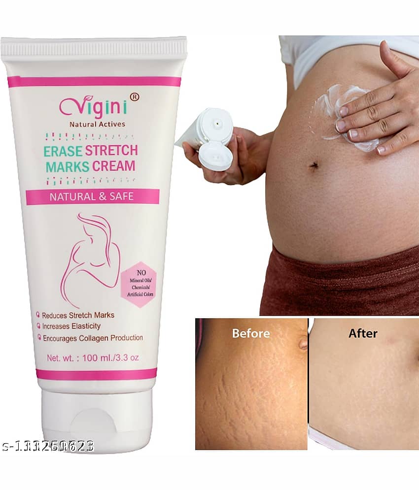Vigini Stretch Marks Scars Removal Cream
