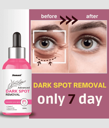 Sonavi Face Serum Niacinamide Fairness For All Skin Type ( Pack of 1 )