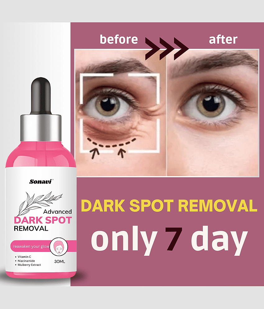 Sonavi Face Serum Niacinamide Fairness For All Skin Type ( Pack of 1 )