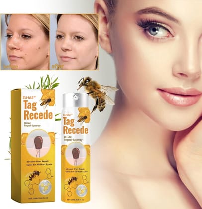 ELHAE Bee Venom Skin Tag Removal Spray, Tag Recede Bee Venom Treatment Spray, Bee Venom Wart and Tags Removal Treatment Spray - 20ml