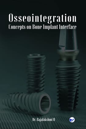 Osseointegration - Concepts on Bone Implant Interface [Paperback] Dr. Rajalakshmi. H