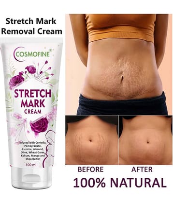 COSMOFINE Skin Tightening Cream Stretch Mark Removal Cream, Shaping & Firming Cream (100 g)