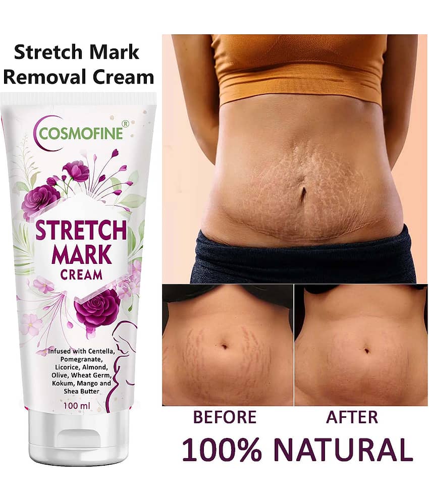 COSMOFINE Skin Tightening Cream Stretch Mark Removal Cream, Shaping & Firming Cream (100 g)