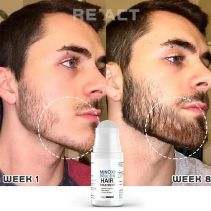 Minoxi Roll-On Hair Growth Serum – Treatment for Dry, Damaged, Curly Hair – Anti-Frizz, Scalp Nourishing, Supports Thicker, Fuller Hair – Easy Roll-On...