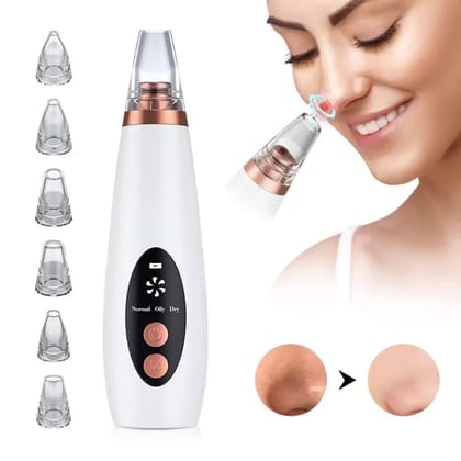 Electric 6-in-1 Multi-Function Blackhead Remover | USB Rechargeable Derma Suction Tool | Acne & Pimple Pore Vacuum Cleaner | Facial Cleansing Device for Nose, Face & Skin Care | With Multiple Suction Heads for Deep Cleaning