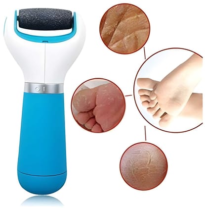 Foot Roller Callus Remover | Hard & Dead Skin Remover | Pedicure Tool for Cracked Feet | Foot Scrubber Roller (Blue)