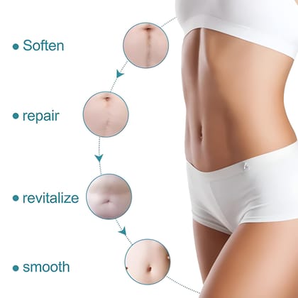Silicone Scar Tape – Reusable Medical Grade Scar Removal Sheets for C-Section, Acne, Keloid & Surgical Scars | Painless Healing Silicone Strips