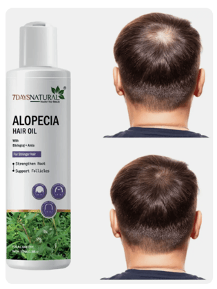 Elegantra Anti Hair Fall Alopecia Oil 100ml pack of 1 | Botanical Hair Growth Solution for Bald Spots & Thin Hair