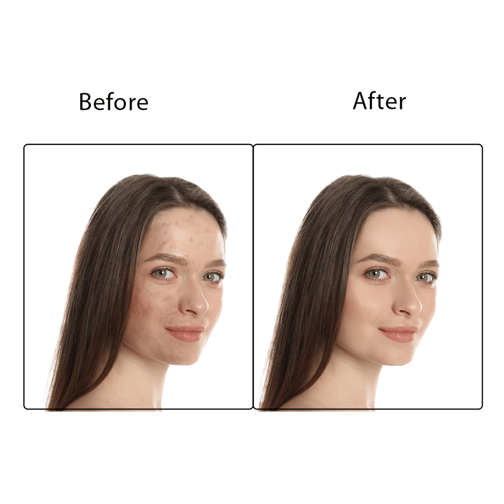 Spring H20 Charcoal Facial Kit 50 gm 2 in 1 Formula Brightening + Repair 5 Step