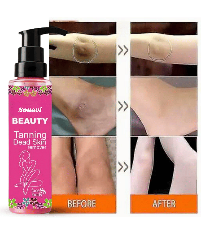 Sonavi Dark Spot Removal Skin Tonic For All Skin Type ( Pack of 1 )