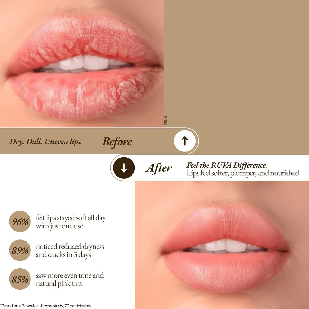 RUVA Soothing Ayurvedic Lip Balm with Natural Pure Damask Rose & Organic Ghee | Nourishing, Herbal Lip Care, Natural Skincare | For All Skin Types - Men & Women