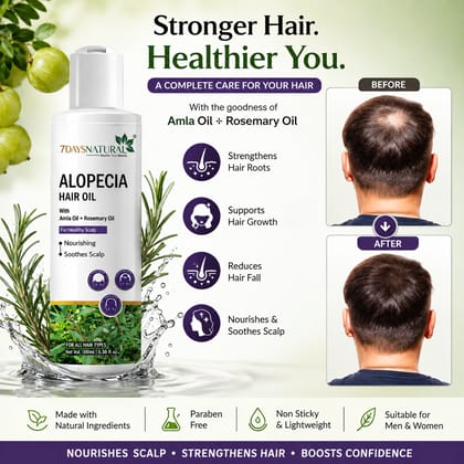 Elegantra Anti Hair Fall Alopecia Oil 100ml pack of 1 | Botanical Hair Growth Solution for Bald Spots & Thin Hair