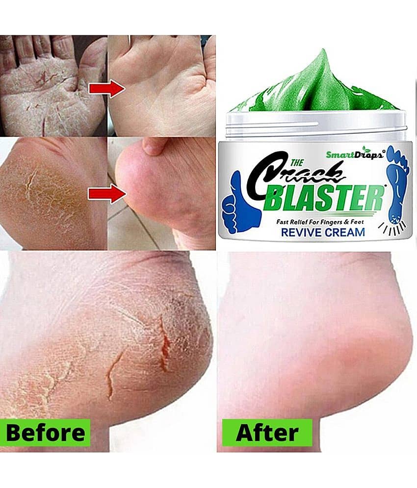 Smartdrops Chapped Hand And Foot Cream Crack Peeling Repair Anti Dry Skin Remove Dead Skin Foot Moisturizing (50gm) (For Women and men) Pack of 3