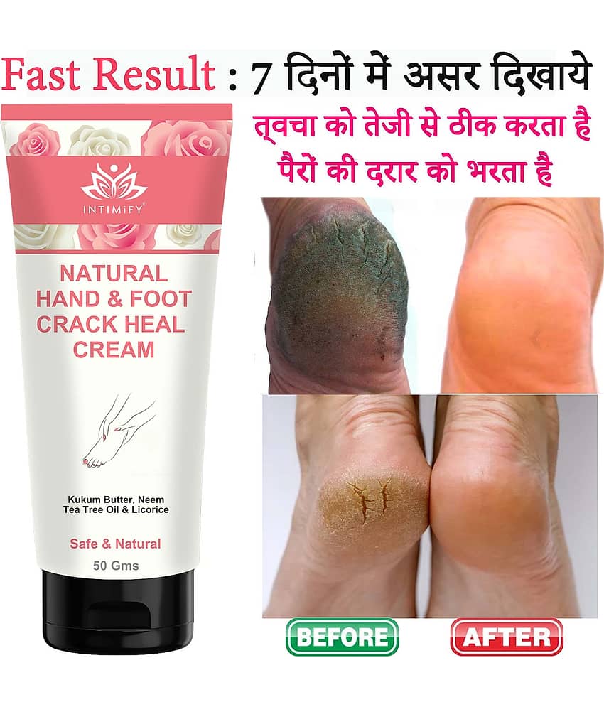 Intimify Crack Heal Cream, Repair Feet Cream, Foot Cream, Chapped Hand And Foot Cream, 50 gms