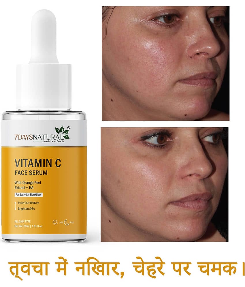 7DAYSNATURAL Face Serum Vitamin C Maintians Skin Complexion For All Skin Type ( Pack of 1 )