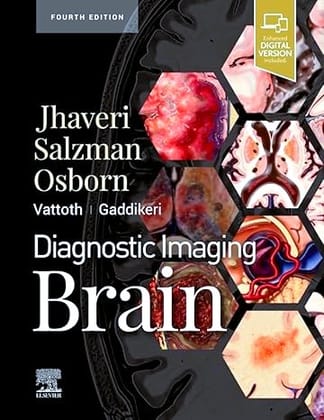 Diagnostic Imaging: Brain, 4ed
