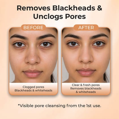 Sanfe Deep Purifying Nose Strips - Pack of 3