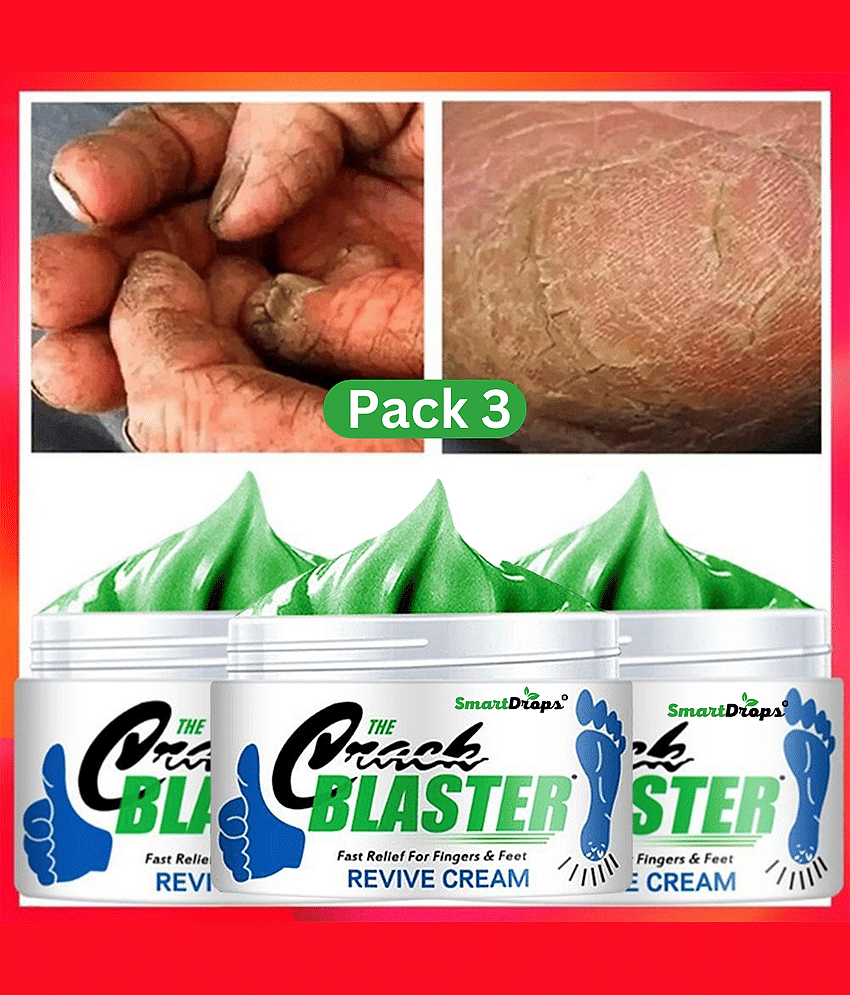 Smartdrops Cracked skin repair Cream for All year ( 50 g )